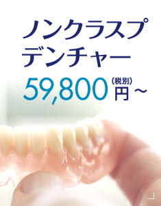 ノンクラスプデンチャー