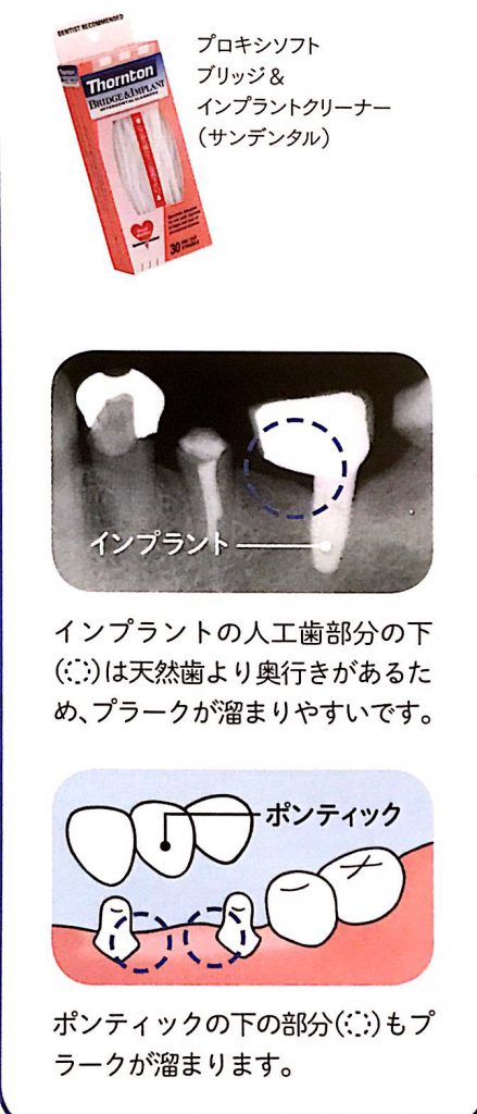 歯ブラシvs歯ブラシ デンタルフロス 飯豊歯科クリニック 南橋本の歯医者さん 歯ブラシvs歯ブラシ デンタルフロス 飯豊歯科クリニック 南橋本の歯医者さん