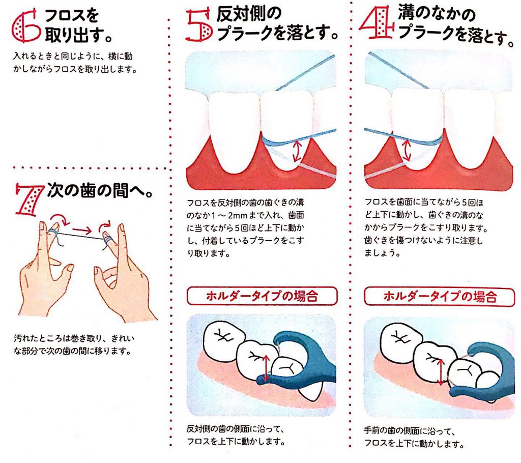 フロス 通す と 痛い 虫歯